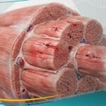 _الالم العضلي