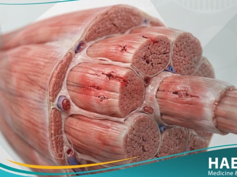 _الالم العضلي