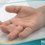 التصاق الأصابع