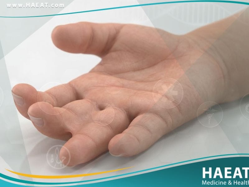 التصاق الأصابع