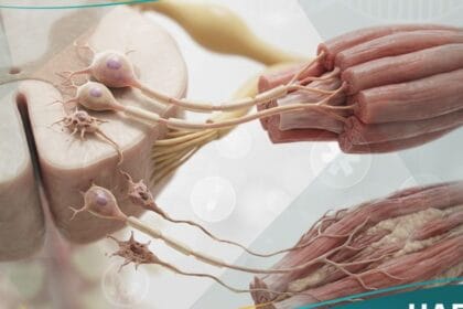 التصلب الضموري العضلي الجانبي