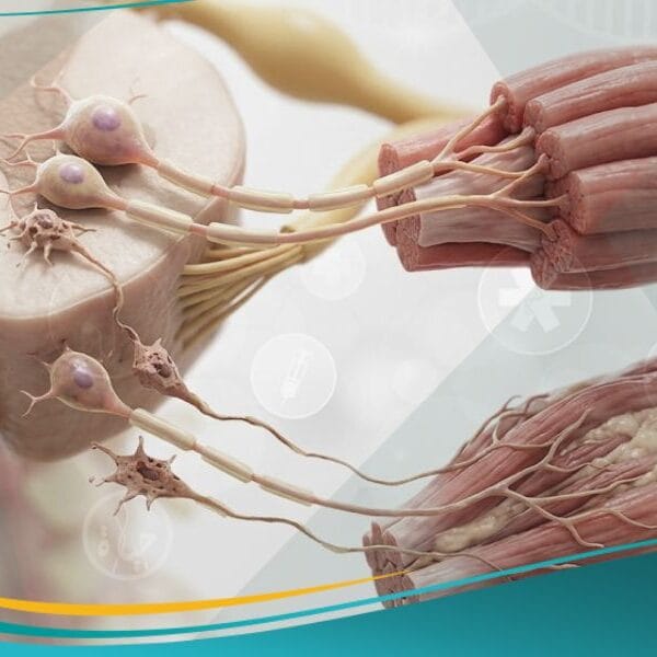 التصلب الضموري العضلي الجانبي