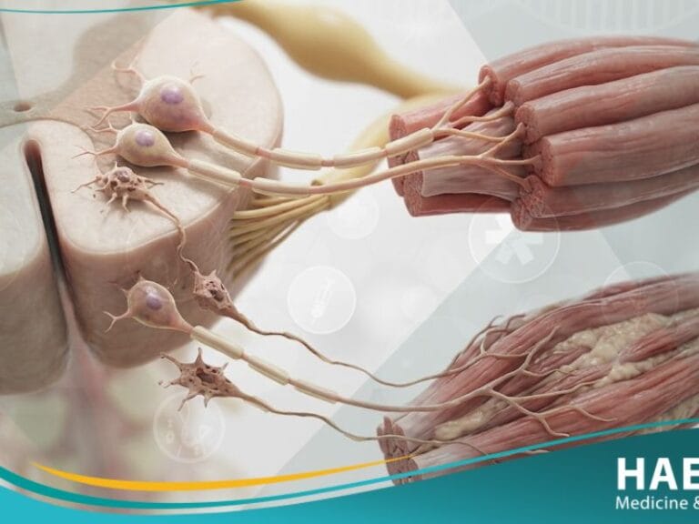 التصلب الضموري العضلي الجانبي