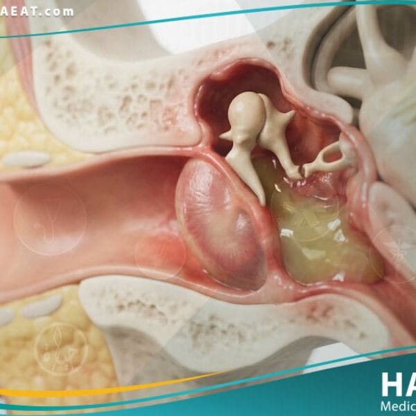 _التهاب الاذن