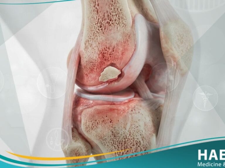 _التهاب العظم والغضروف