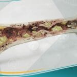 التهاب العظم والنقي