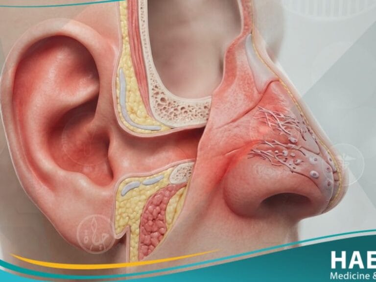 التهاب الغضروف (2)