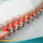 _التهاب الفقار