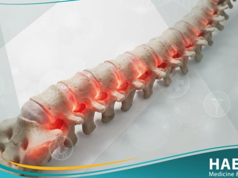 _التهاب الفقار