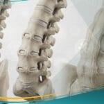 التهاب الفقرات التصلبي