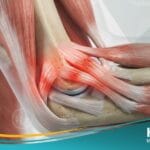 _التهاب اللقيمة