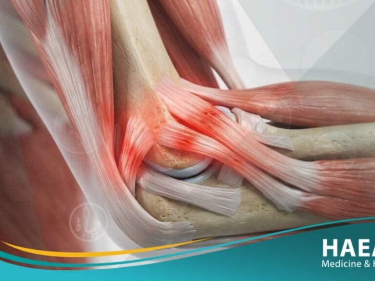 _التهاب اللقيمة