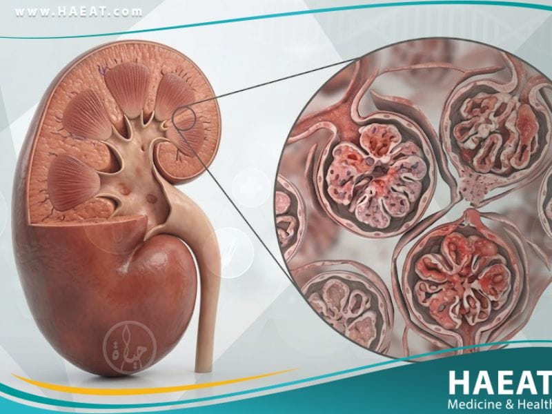 التهاب كبيبات الكلى لدى الأطفال