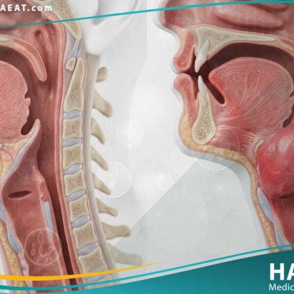 التهاب لسان المزمار