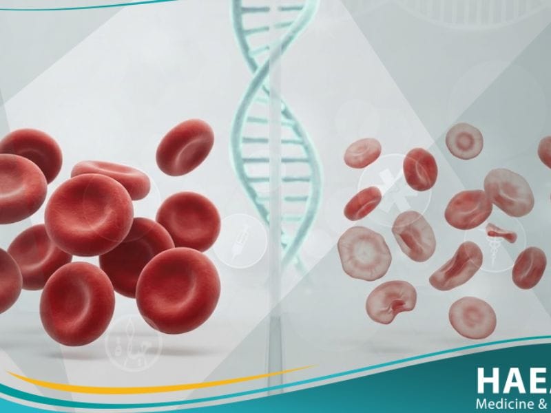 الثلاسيميا