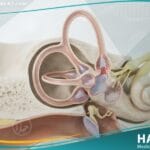 الدوار الانتيابي الحميد لدى الأطفال