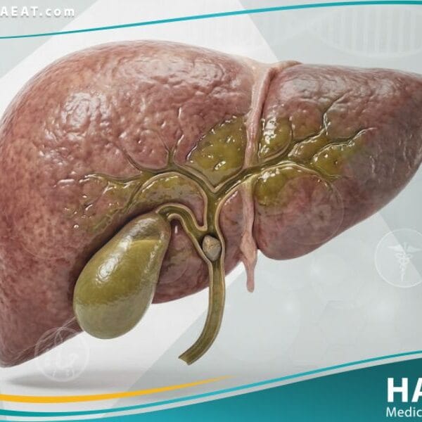 _الركود الصفراوي