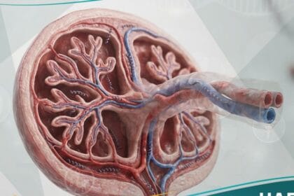 _الزهري الخلقي