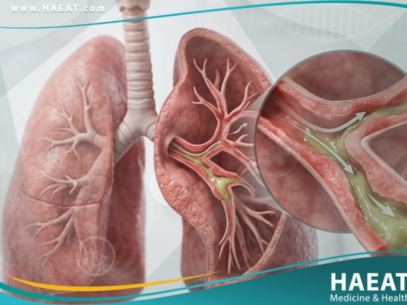 السعال عند الاطفال