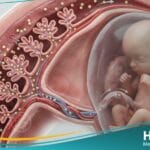 السكري الحملي