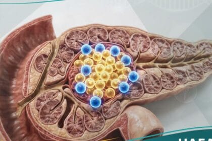 _السكري الذاتية للبالغين