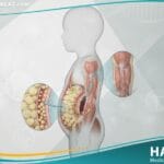 _السمنة لدى الأطفال (1)