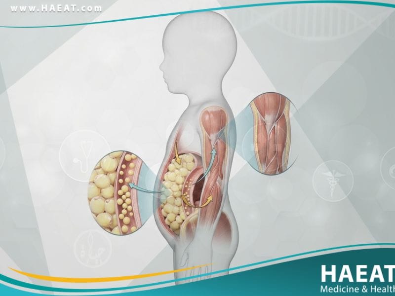 _السمنة لدى الأطفال (1)