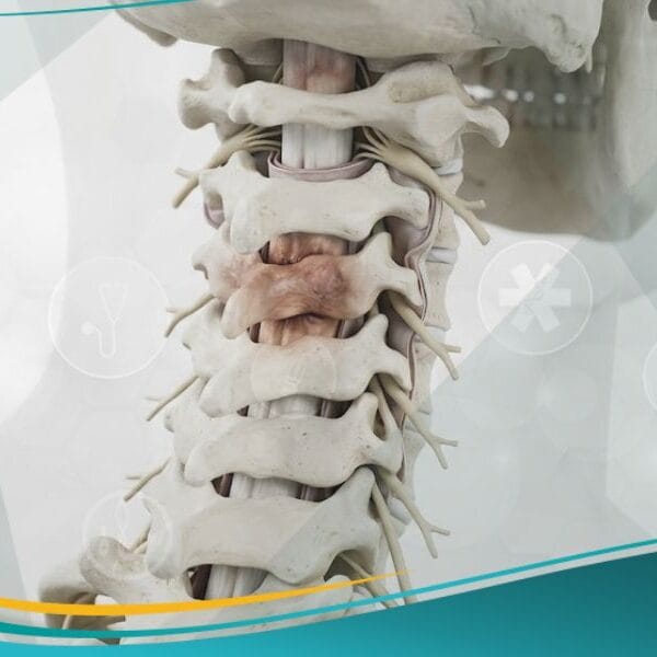 الشلل الرباعي