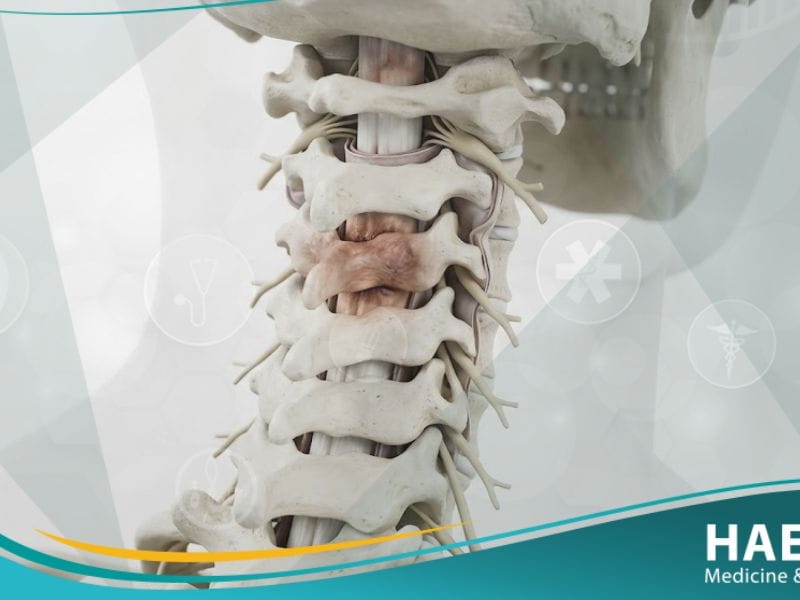 الشلل الرباعي