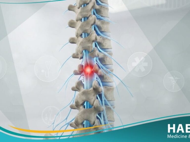 الشلل السفلي