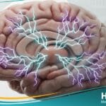 الصرع الصغير