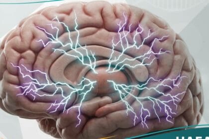 الصرع الصغير