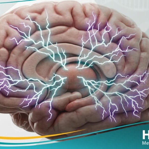 الصرع الصغير