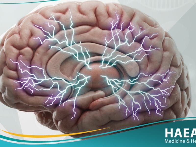 الصرع الصغير