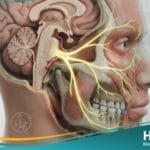 العصب الثلاثي التوائم