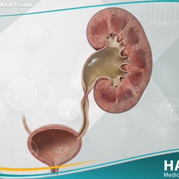 _العيوب الخلقية في المسالك البولية