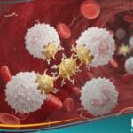 الفرفرية القليلة الصفيحات المجهولة السبب