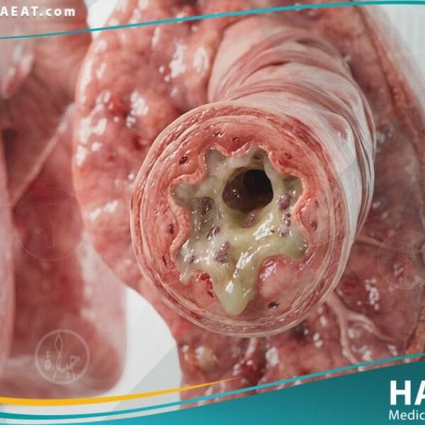 _الفيروس المخلوي التنفسي