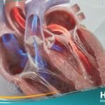 القلس المترالي