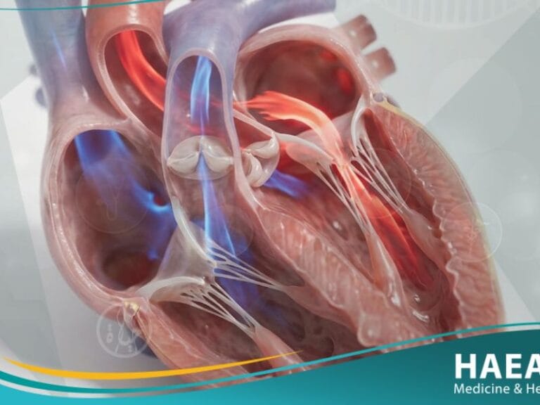 القلس المترالي