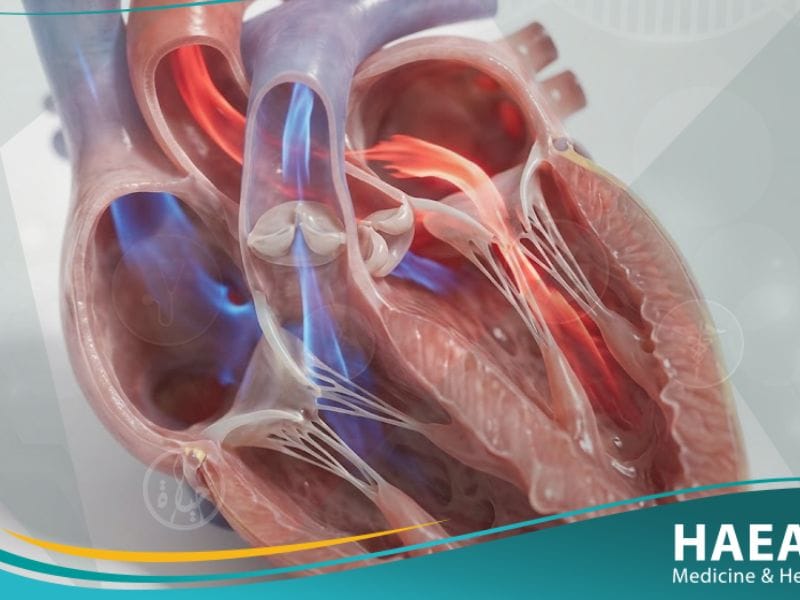 القلس المترالي