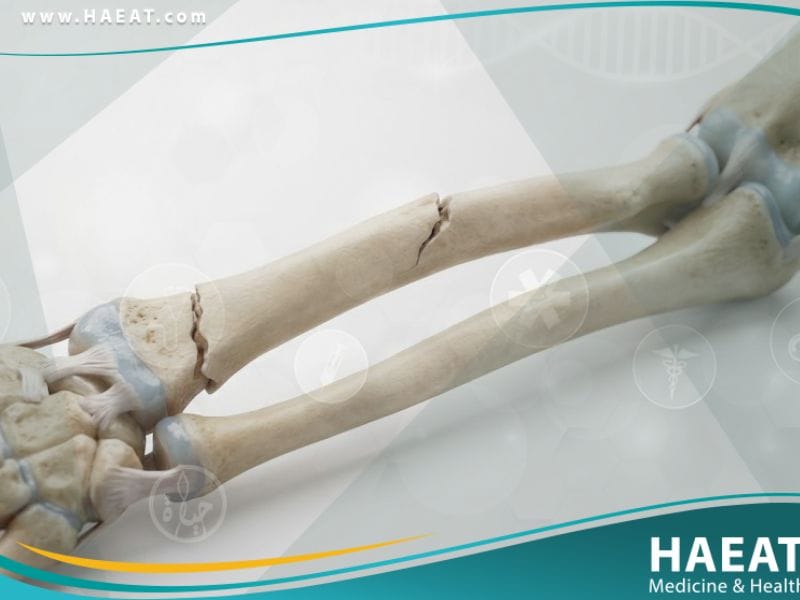 الكسور الشائعة لدى الأطفال