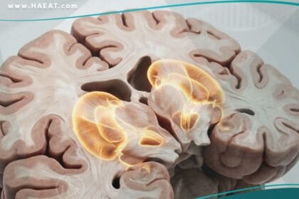 الكنع الرقصي