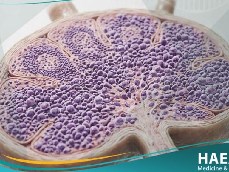 اللمفومة اللاهودجكينية