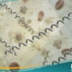 الملتويات (1)