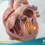 النبضات البطينية الباكرة