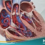 _النفخة القلبية