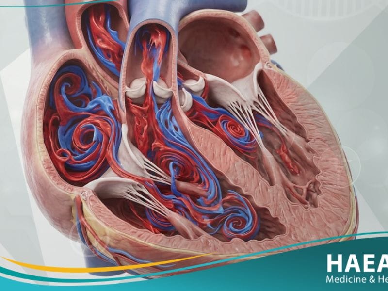 _النفخة القلبية