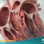 النوبة القلبية