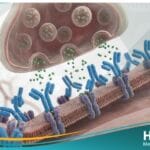 الوهن العضلي الوبيل